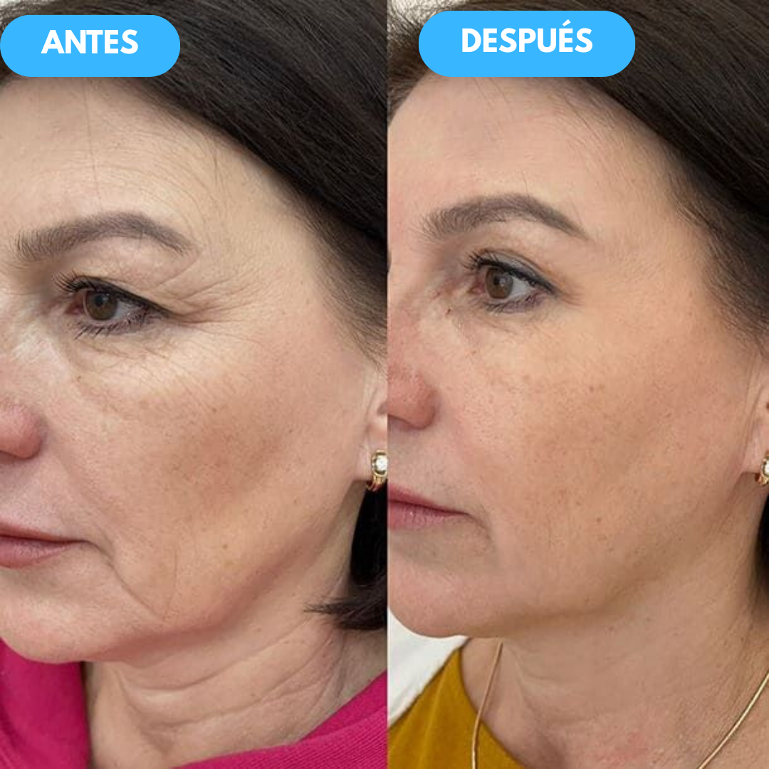 1+1 GRATIS| Nida™ - La solución definitiva para eliminar ojeras y bolsas del contorno de tus ojos