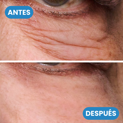 1+1 GRATIS | Sovana Quingling - Crema Facial Coreana con Acción Reafirmante