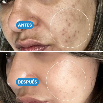 Sovana Exosome - Sérum Rejuvenecedor con Exosomas potenciadoras de colágeno