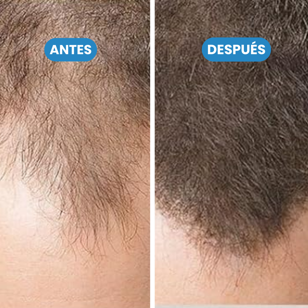 Sanorys Botana - Champú de Crecimiento Capilar con Aceite de Botana