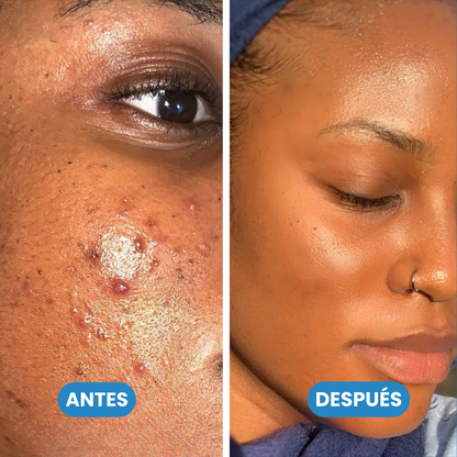 Sovana Ordinary - Sérum exfoliante para una piel luminosa sin manchas