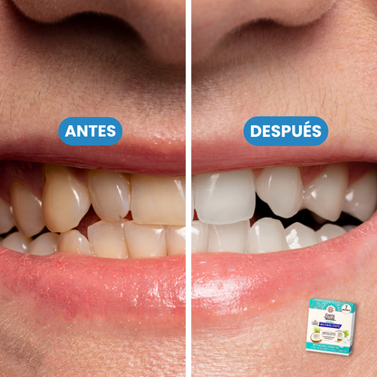 Gurunanda - Tiras blanqueadoras para una sonrisa 10