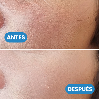 Sovana Seoul – Crema de retinol 7 días | LIBRO + SÉRUM HIDRALIFT GRATIS