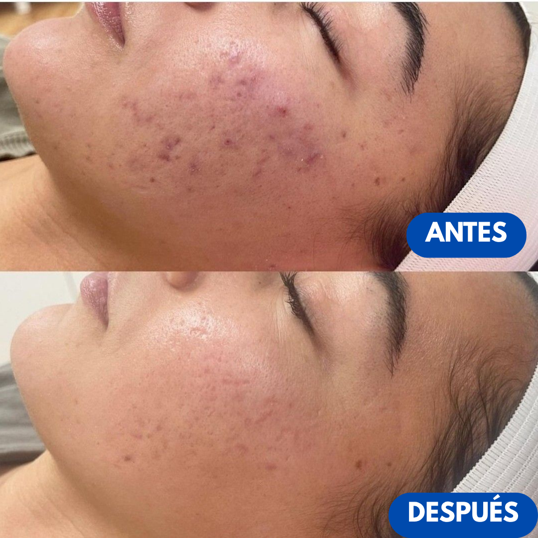 Sovana Melaxin - Pack exfoliante natural de arroz