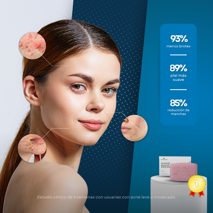 Sovana Revitalex - Jabón exfoliante con ácido salicílico anti-acné