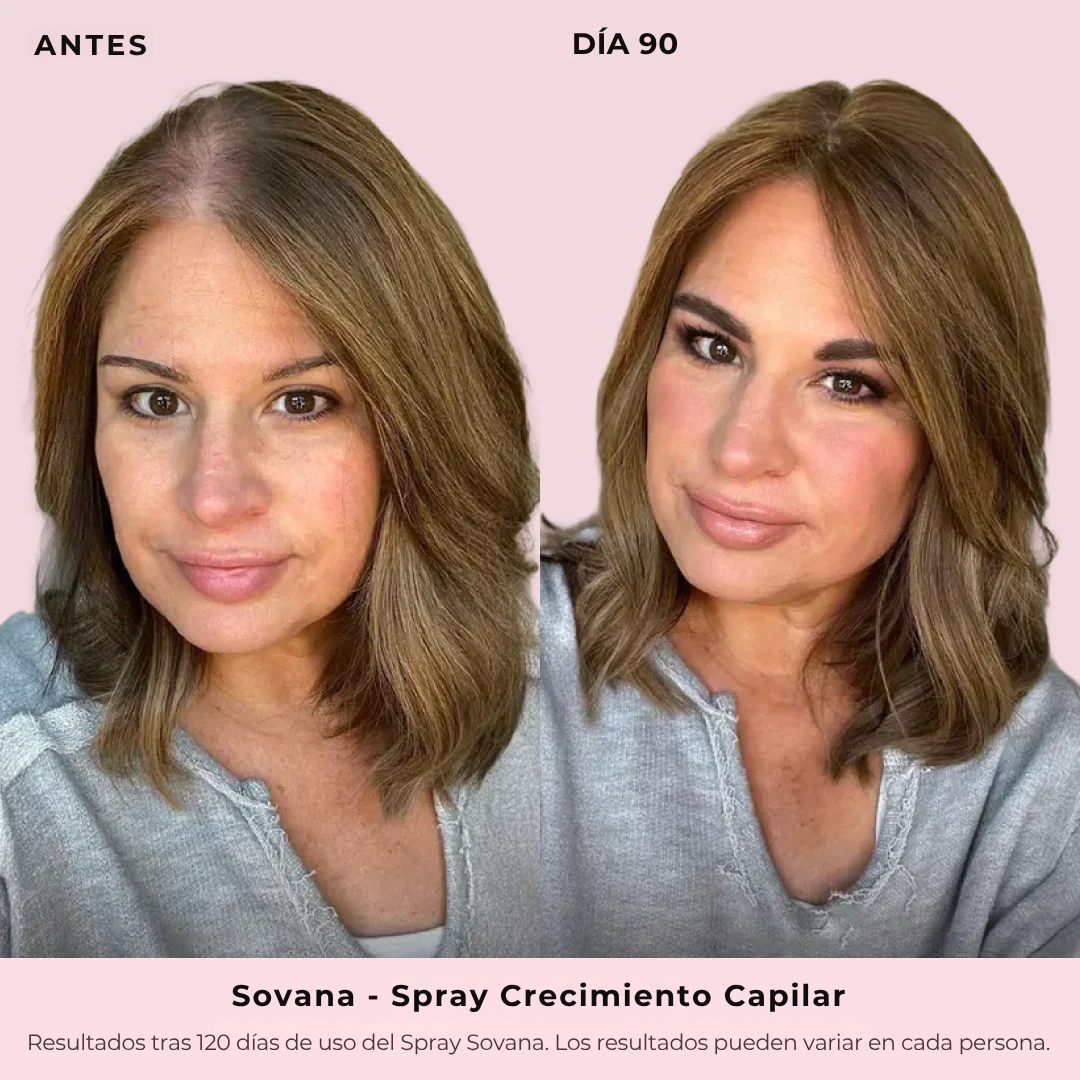Sovana - Spray de Crecimiento Capilar