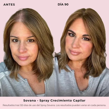 Sovana - Spray de Crecimiento Capilar