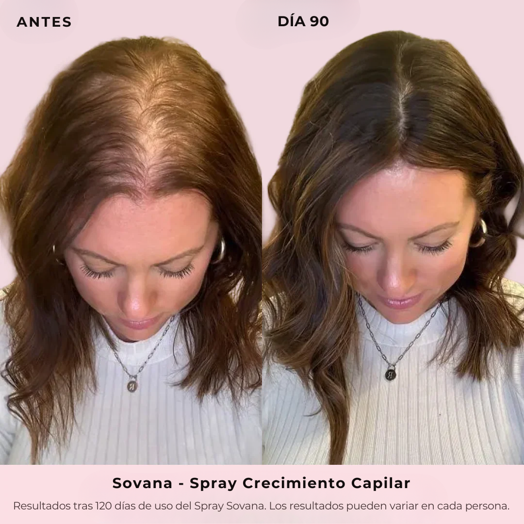 Sovana - Spray de Crecimiento Capilar