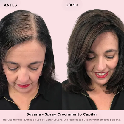 Sovana - Spray de Crecimiento Capilar