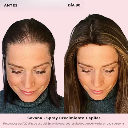 Sovana - Spray de Crecimiento Capilar