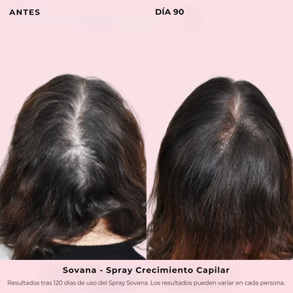 Sovana - Spray de Crecimiento Capilar