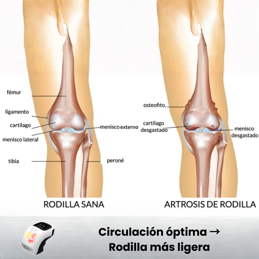 Sovana - Masajeador eléctrico para el dolor de rodilla