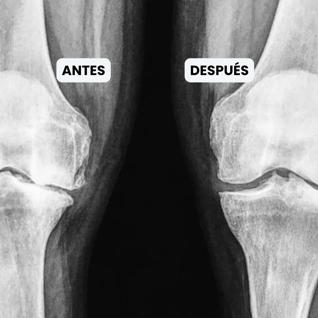 Sovana - Masajeador eléctrico para el dolor de rodilla