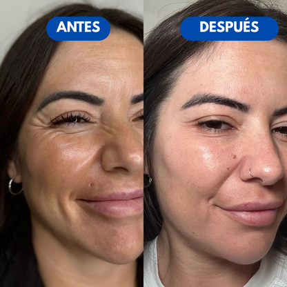 Sovana Tarte™ - El único corrector de ojeras con tecnología SkinSync™