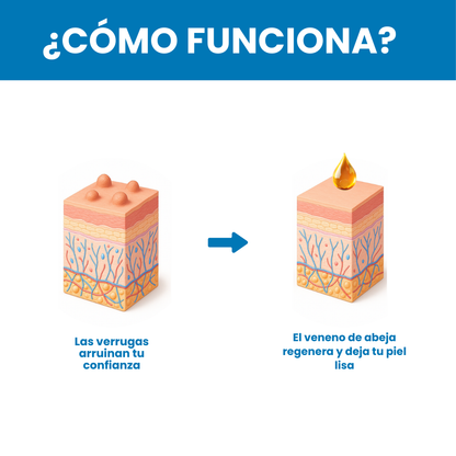 Sovana Bee - Crema para eliminar verrugas con Veneno de Abeja