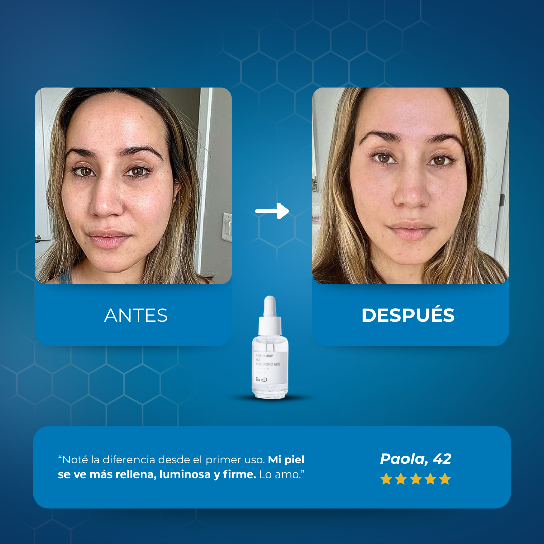 Sovana HialuLift³ – Sérum Triple Ácido Hialurónico Volumen + Firmeza