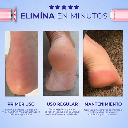 FootZen™ - Suaviza tus pies y elimina todos tus callos desde el primer día