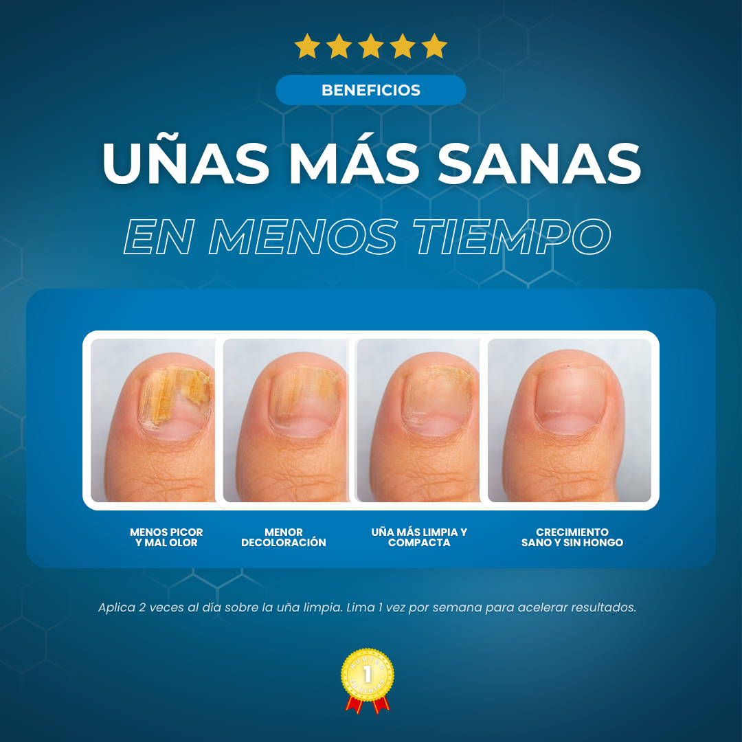 Sanorys Fung - Líquido para eliminar hongos de las uñas