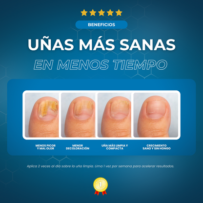 Sanorys Fung - Líquido para eliminar hongos de las uñas