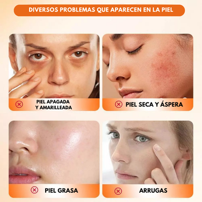 Sovana Sadoer™ - Tóner Anti-Edad para Borrar años de tu rostro en 7 Días