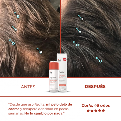 Revita™ - Champú Revitalizador de Densidad Capilar No Invasivo