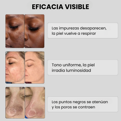 Erysse - Exfoliante coreano para una piel nueva en 3 minutos