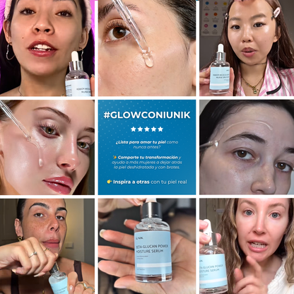 Sovana Iunik - Sérum para Pieles deshidratad y propensas al acné