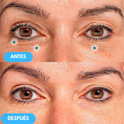1+1 GRATIS| Nida™ - La solución definitiva para eliminar ojeras y bolsas del contorno de tus ojos