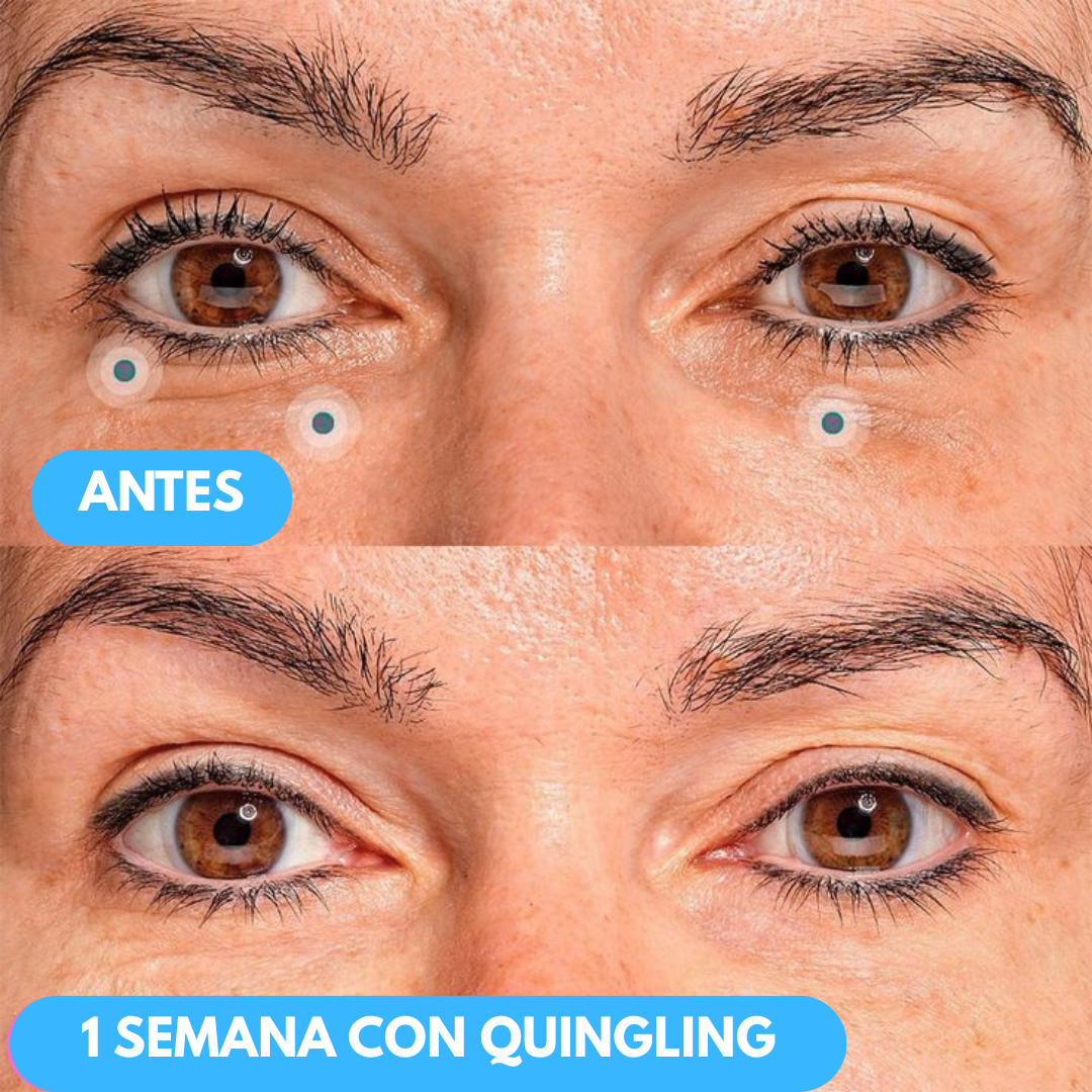 1+1 GRATIS | Sovana Quingling - Crema Facial Coreana con Acción Reafirmante