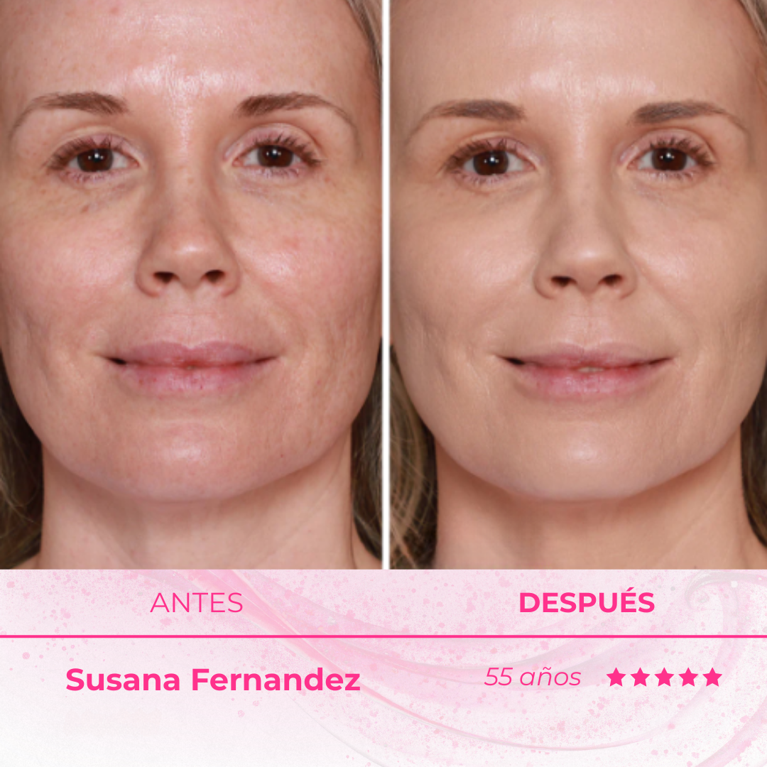 LumiBounce™ - Bálsamo con péptidos que hidrata, difumina y da brillo natural.