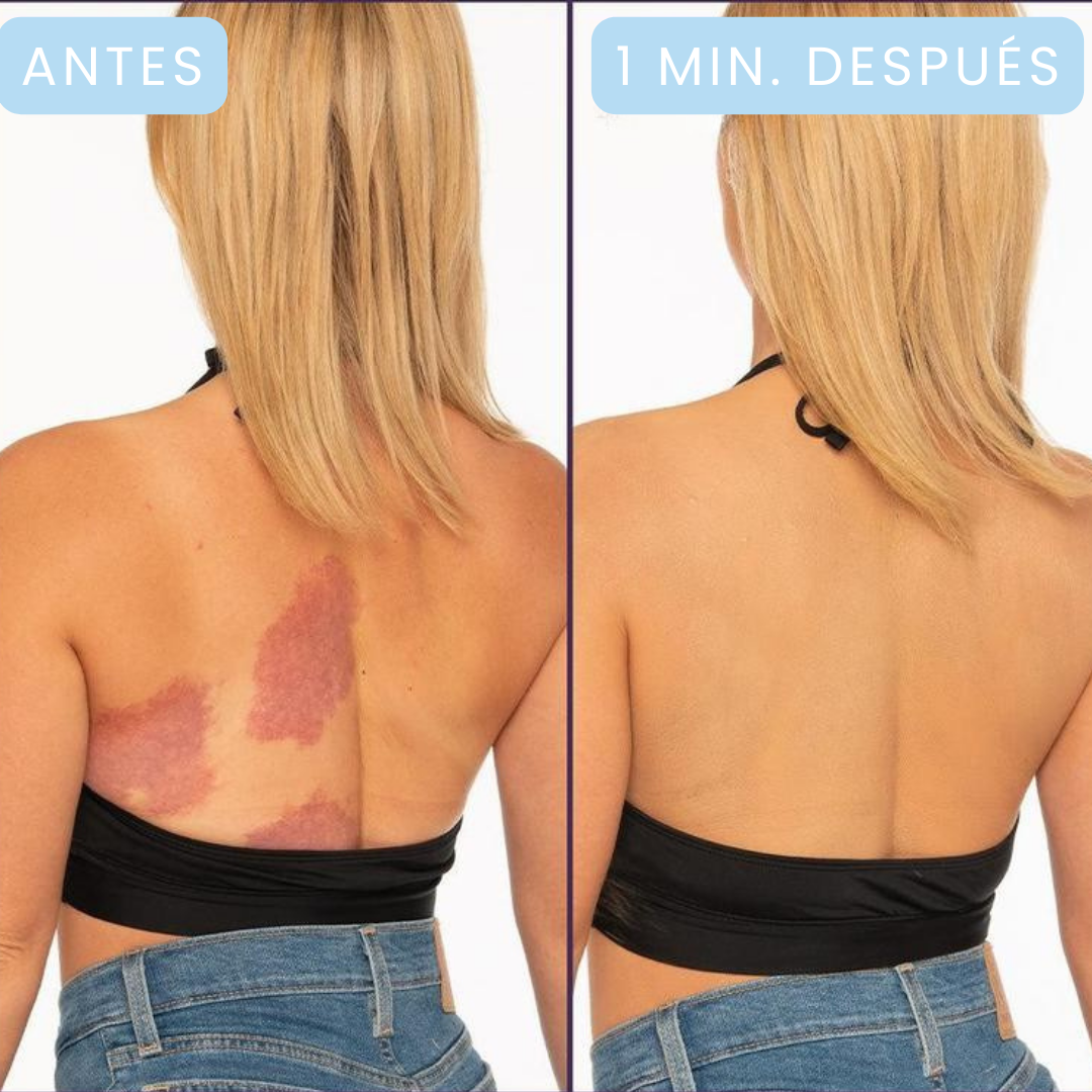 Westmore Beauty™ - El Maquillaje Corporal que Oculta Varices, Manchas y Cicatrices